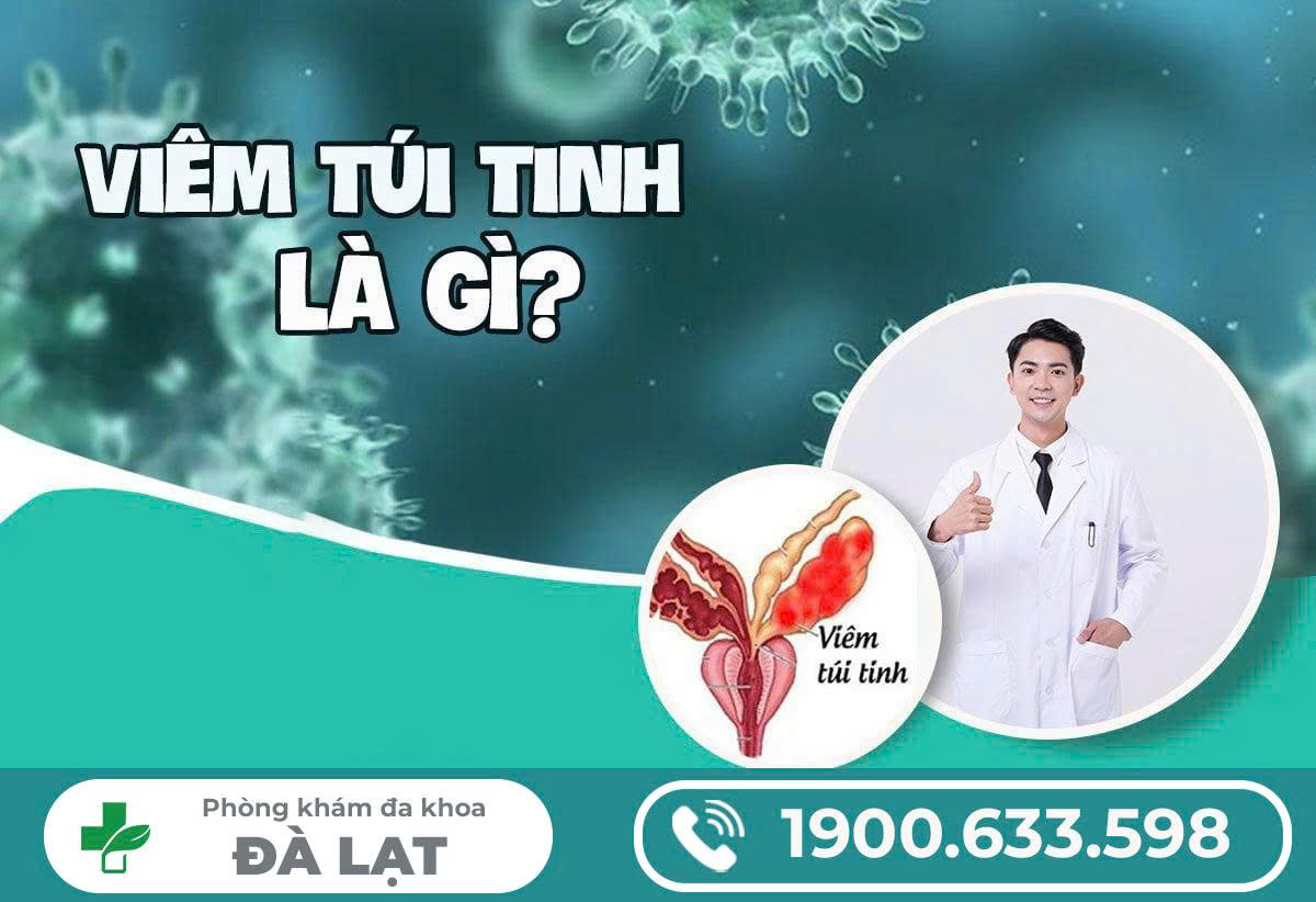 Hình ảnh minh họa